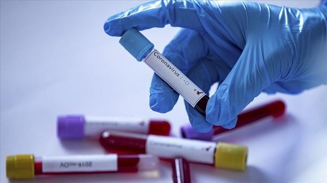 ارتفاع حالات الإصابة بفيروس كورونا في الصومال