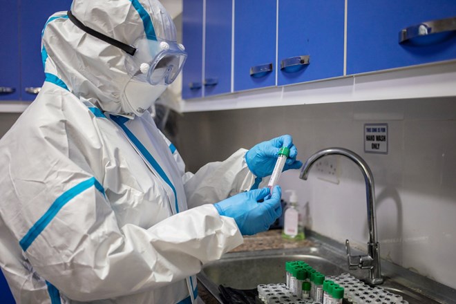 ارتفاع الإصابات بفيروس كورونا في الصومال