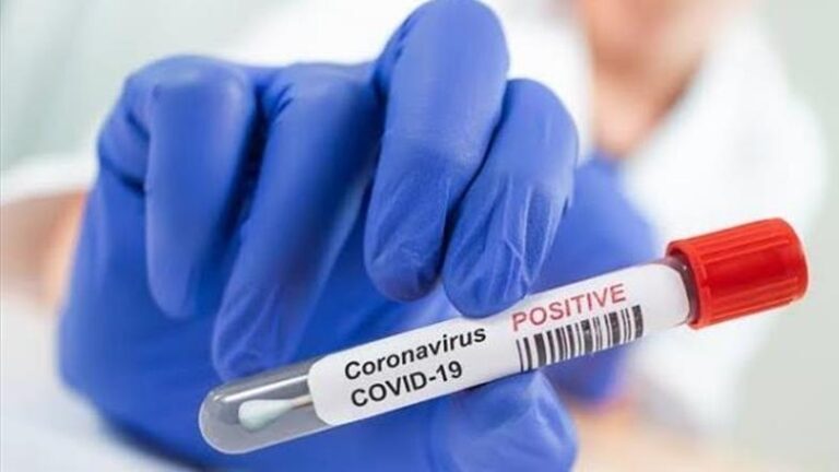 3 Inter Milan players test positive for Covid19